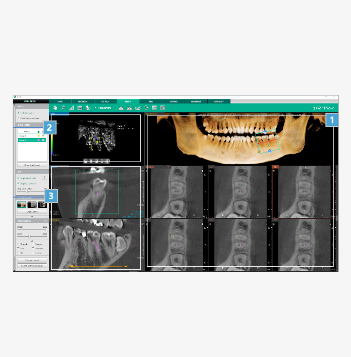 Ez Endo