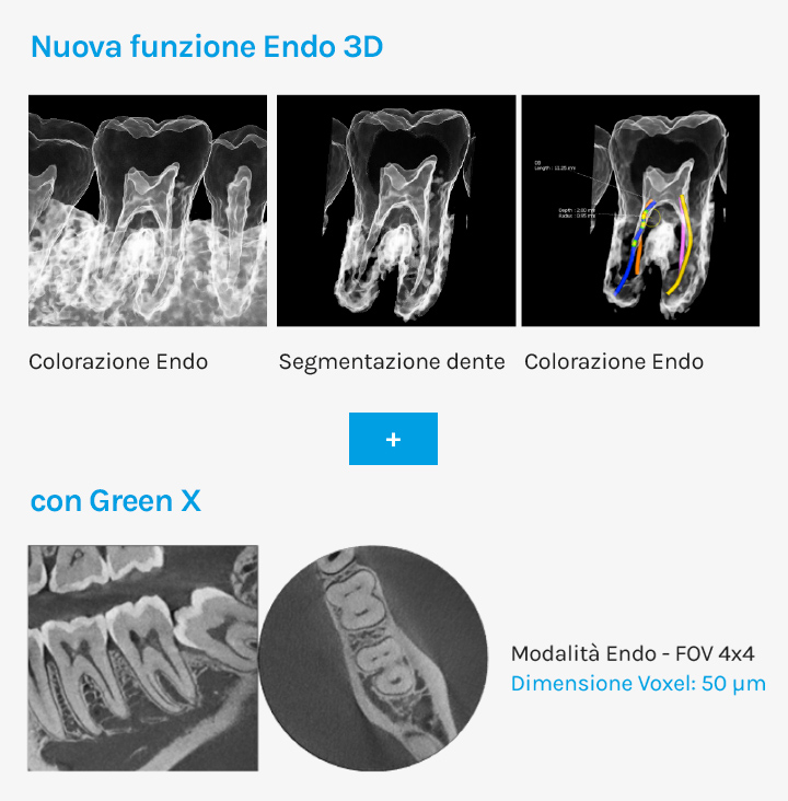 Ez Endo